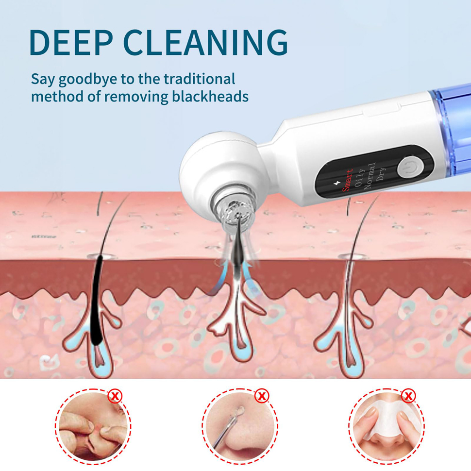 Removedor de Puntos Negros, Li - Pore Vacuum reseña y precio